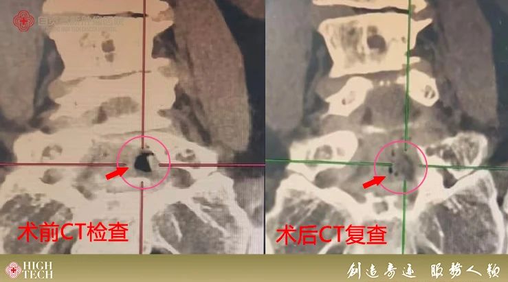 腳痛、坐立不安？這項(xiàng)治療可以助你恢復(fù)活力