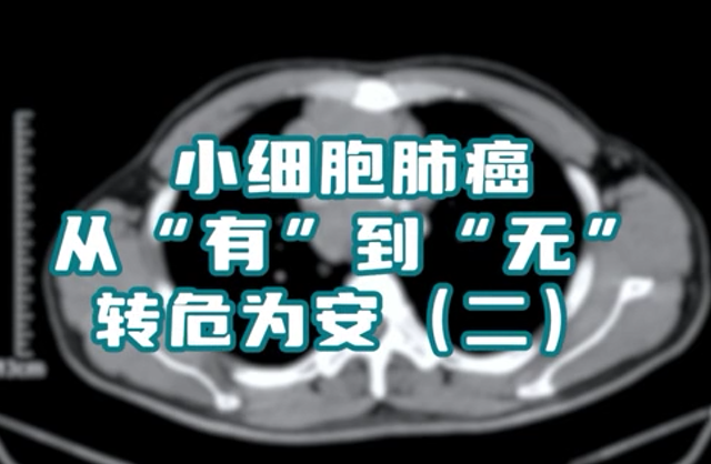 小細(xì)胞肺癌患者，縱隔淋巴結(jié)腫大，情況危急。通過(guò)介入綜合治療，病灶已基本消失