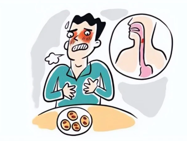 【食管癌】食管狹窄“一線(xiàn)天”，球囊粒子打通它！